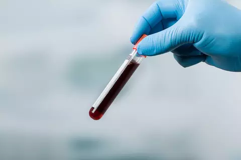 ldl-cholesterinspiegel-faktoren-geistige-fitness-probrain